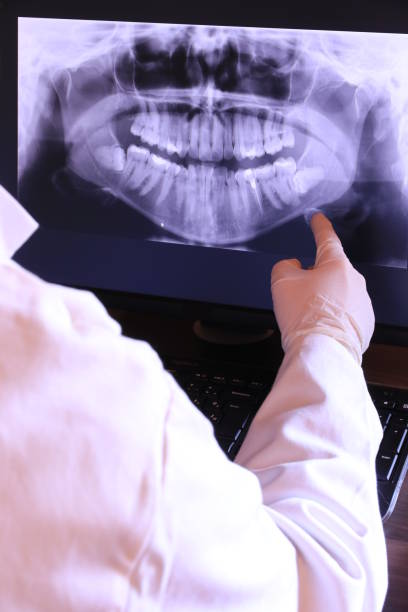 Best Emergency Wisdom Teeth Removal in Holley, NY