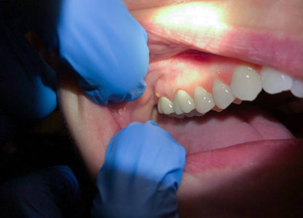 Best Emergency Dental Surgery in Holley, NY