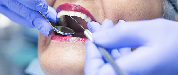 Best Emergency Treatment for Toothache in Holley, NY